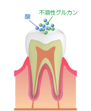 歯の質